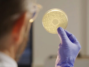 BioGaia Probiotics man looking at petri dish